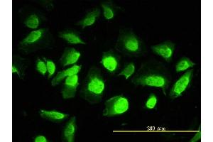 Immunofluorescence of monoclonal antibody to ANP32A on HeLa cell. (PHAP1 antibody  (AA 1-249))