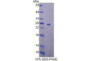 SDS-PAGE analysis of Mouse BAG5 Protein. (BAG5 Protein)
