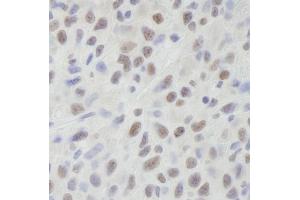 Immunohistochemistry (IHC) image for anti-ATP-Dependent RNA Helicase A (DHX9) (C-Term) antibody (ABIN7448530) (DHX9 antibody  (C-Term))