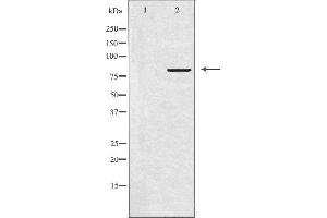 Western blot analysis of extracts from LOVO cells, using APBB2 antibody.