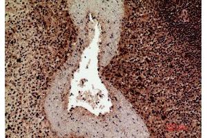 Immunohistochemistry (IHC) analysis of paraffin-embedded Human Spleen, antibody was diluted at 1:100. (HLA-DQ1/DQ2 antibody  (Internal Region))