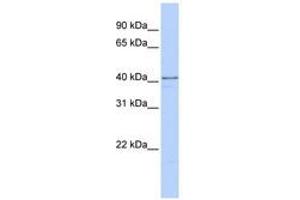 Image no. 1 for anti-Heterogeneous Nuclear Ribonucleoprotein D-Like (HNRPDL) (C-Term) antibody (ABIN6740681) (HNRPDL antibody  (C-Term))