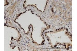 Image no. 1 for anti-Zinc Fingers and Homeoboxes 3 (ZHX3) (AA 863-955) antibody (ABIN599532) (ZHX3 antibody  (AA 863-955))