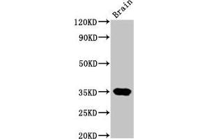 Western Blot Positive WB detected in: Rat brain tissue All lanes: NKX3-2 antibody at 4. (NKX3-2 antibody  (AA 1-333))
