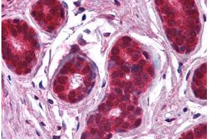 Human Breast (formalin-fixed, paraffin-embedded) stained with NFKBIA antibody ABIN218609 at 1:1000 followed by biotinylated goat anti-rabbit IgG secondary antibody ABIN481713, alkaline phosphatase-streptavidin and chromogen. (NFKBIA antibody  (C-Term))