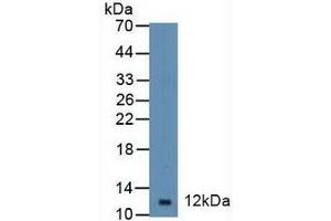 Detection of DBI in Mouse Spleen Tissue using Polyclonal Antibody to Diazepam Binding Inhibitor (DBI) (Diazepam Binding Inhibitor antibody  (AA 1-104))