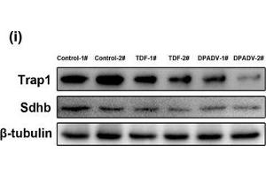 Effects of TDF and DPADV administration for 16-week on mouse kidney. (TRAP1 antibody)
