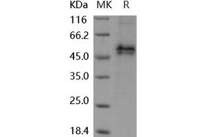 Western Blotting (WB) image for Follistatin (FST) (Active) protein (His tag) (ABIN7320423) (Follistatin Protein (FST) (His tag))