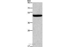 Western blot analysis of Mouse stomach tissue, using CTSE Polyclonal Antibody at dilution of 1:525 (Cathepsin E antibody)