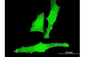 Immunofluorescence of monoclonal antibody to ACAN on HeLa cell. (Aggrecan antibody  (AA 56-155))