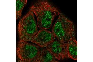 Immunofluorescent staining of A-431 cells using DUSP10 polyclonal antibody  shows positivity in nucleus (green) but excluded from the nucleoli. (DUSP10 antibody  (AA 180-291))