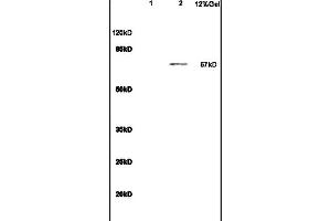 Lane 1: mouse heart lysates Lane 2: S/P20 Cell lysates probed with Anti IL-23R Polyclonal Antibody, Unconjugated (ABIN686857) at 1:200 in 4 °C. (IL23R antibody  (AA 401-550))