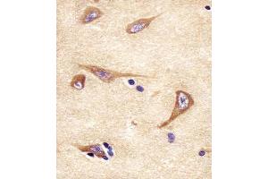 (ABIN652309 and ABIN2841413) staining NPTX1 in human brain tissue sections by Immunohistochemistry (IHC-P - paraformaldehyde-fixed, paraffin-embedded sections). (NPX1 antibody  (AA 322-350))