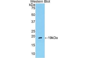 Detection of Recombinant ANGPT1, Rat using Polyclonal Antibody to Angiopoietin 1 (ANGPT1) (Angiopoietin 1 antibody  (AA 304-450))