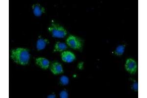 Immunofluorescence (IF) image for anti-Calcium Binding and Coiled-Coil Domain 2 (CALCOCO2) antibody (ABIN1497075)