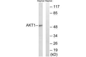 Western blot analysis of extracts from HuvEc cells, treated with Serum (30 % , 30 mins), using Akt (Ab-129) antibody. (AKT1 antibody  (Ser129))