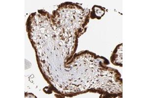 Immunohistochemical staining of human placenta with IGF2BP3 polyclonal antibody  shows strong cytoplasmic and nuclear positivity in trophoblastic cell at 1:50-1:200 dilution.