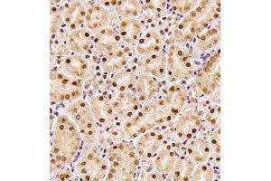 Immunohistochemistry (Paraffin-embedded Sections) (IHC (p)) image for anti-Zinc Fingers and Homeoboxes 3 (ZHX3) antibody (ABIN7076287)