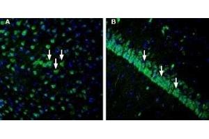 Expression of IGF1R in rat cortex and hippocampus - Immunohistochemical staining of perfusion-fixed frozen rat brain sections with Anti-IGF1R (extracellular) Antibody (ABIN7043290, ABIN7044798 and ABIN7044799), (1:1200), followed by goat anti-rabbit-AlexaFluor-488. (IGF1R antibody  (Extracellular, N-Term))