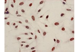 Immunocytochemistry analysis of Hela cells using ABIN7139199 at dilution of 1:100 (HIST1H4A antibody  (acLys8))