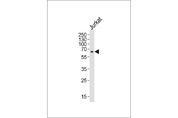 IL2RG antibody  (N-Term)