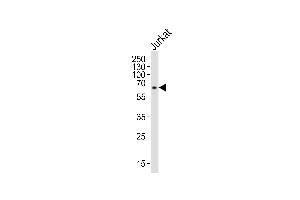 Western blot analysis of lysate from Jurkat cell line, using IL2RG Antibody (N-term) (ABIN653403 and ABIN2842858).