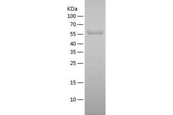 CES1C Protein (AA 19-550) (His tag)
