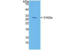Western blot analysis of recombinant Mouse MAPK7. (MAPK7 antibody  (AA 185-419))