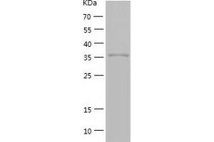 GMPR Protein (AA 1-345) (His tag)