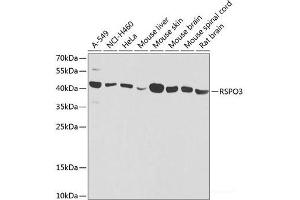 Western blot analysis of extracts of various cell lines using RSPO3 Polyclonal Antibody at dilution of 1:1000. (R-Spondin 3 antibody)