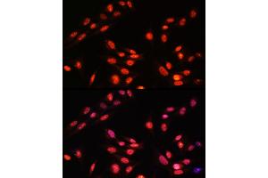Immunofluorescence analysis of Rat colon using CTSC antibody (ABIN7267936) at dilution of 1:100 (40x lens). (ESRRA antibody  (AA 1-423))