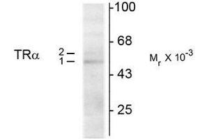 Western Blotting (WB) image for anti-Thyroid Hormone Receptor, alpha (THRA) (N-Term) antibody (ABIN371844)