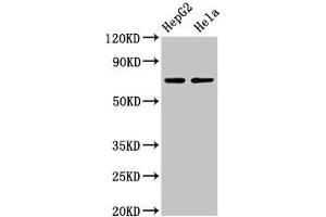 Western Blot Positive WB detected in: HepG2 whole cell lysate, Hela whole cell lysate All lanes: AMFR antibody at 4 μg/mL Secondary Goat polyclonal to rabbit IgG at 1/50000 dilution Predicted band size: 73 kDa Observed band size: 73 kDa (AMFR antibody  (AA 485-643))
