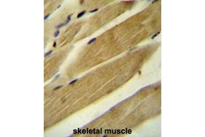 RPH3A Antibody (C-term) immunohistochemistry analysis in formalin fixed and paraffin embedded human skeletal muscle followed by peroxidase conjugation of the secondary antibody and DAB staining. (RPH3AL antibody  (C-Term))