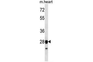 STX8 Antibody (N-term) western blot analysis in mouse heart tissue lysates (35µg/lane). (STX8 antibody  (N-Term))