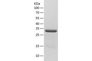 Western Blotting (WB) image for PDZ Binding Kinase (PBK) (AA 1-322) protein (His tag) (ABIN7288390) (PBK Protein (AA 1-322) (His tag))