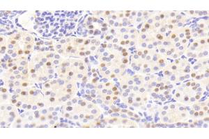 Immunohistochemistry (IHC) image for anti-Acidic (Leucine-Rich) Nuclear phosphoprotein 32 Family, Member A (ANP32A) (AA 2-175) antibody (ABIN7437665)