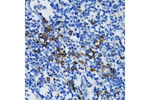 Immunohistochemistry of paraffin-embedded human tonsil using STAT3 antibody (ABIN5998978) at dilution of 1/100 (40x lens).