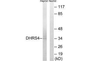 Western blot analysis of extracts from HepG2 cells, using DHRS4 antibody. (DHRS4 antibody  (C-Term))
