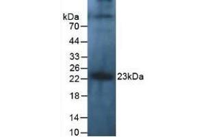 Detection of IL10 in Human Leukocyte Cells using Polyclonal Antibody to Interleukin 10 (IL10) (IL-10 antibody  (AA 1-178))