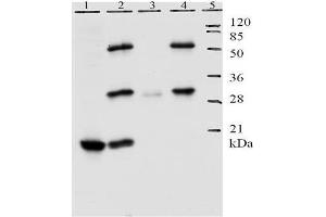 Lane 1 shows detection of E7 protein by Mab 8G6 in lysate of U20S cells. (Human Papilloma Virus 11 E7 (HPV-11 E7) (AA 1-35) antibody)