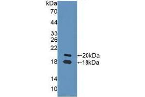 Detection of Recombinant NRG1, Rat using Polyclonal Antibody to Neuregulin 1 (NRG1) (Neuregulin 1 antibody  (AA 264-393))