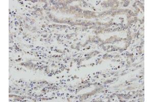 Immunohistochemistry (IHC) image for anti-Apoptosis-Inducing Factor, Mitochondrion-Associated, 1 (AIFM1) (N-Term) antibody (ABIN2855383)