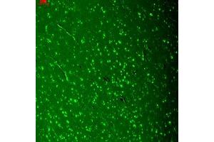 Cav1. (CACNA1D antibody  (AA 859-875))