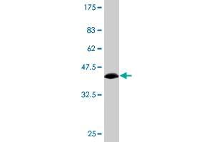 Western Blot detection against Immunogen (36. (PIK3R4 antibody  (AA 1259-1358))