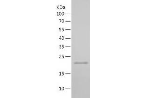 Western Blotting (WB) image for Cyclin-Dependent Kinase Inhibitor 2A (Melanoma, P16, Inhibits CDK4) (CDKN2A) (AA 1-156) protein (His tag) (ABIN7282400) (CDKN2A Protein (AA 1-156) (His tag))
