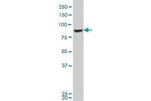 GPHN polyclonal antibody (A01), Lot # 060118JC01 Western Blot analysis of GPHN expression in Jurkat . (Gephyrin antibody  (AA 677-769))