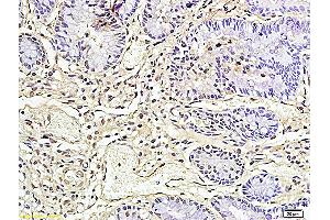 Formalin-fixed and paraffin embedded rat colon tissue labeled with Anti CD177/NB1 Polyclonal Antibody, Unconjugated (ABIN687187) at 1:200 followed by conjugation to the secondary antibody and DAB staining. (CD177 antibody  (AA 521-650))