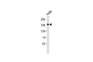 Western blot analysis of lysate from Hela cell line, using GTF2I Antibody at 1:1000.