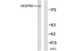 Western Blotting (WB) image for anti-VEGF Receptor 2 (VEGFR2) (AA 917-966) antibody (ABIN2889081) (VEGFR2/CD309 antibody  (AA 917-966))